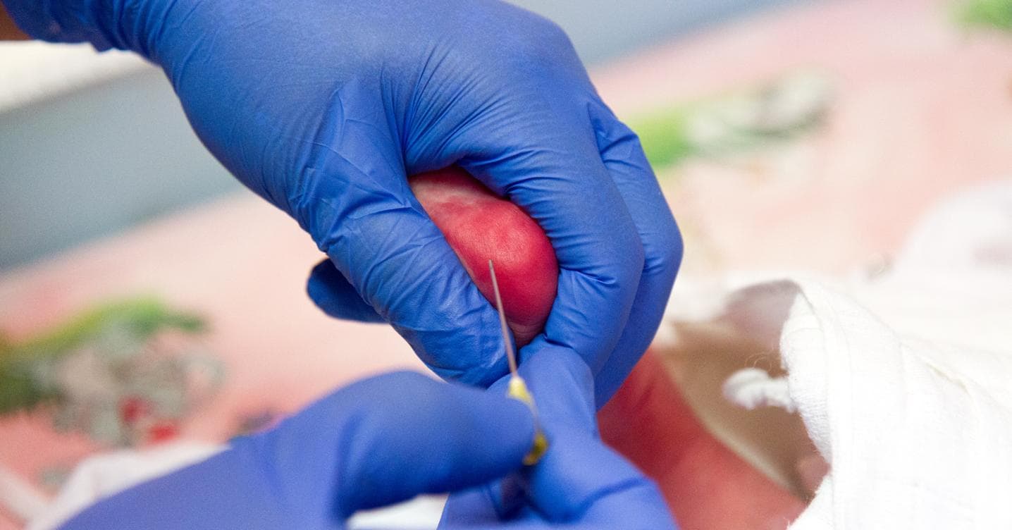 Screening neonatale: una goccia di sangue può cambiare una vita ma serve uno standard